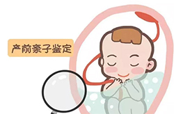 四川怀孕需要怎么办理DNA亲子鉴定
